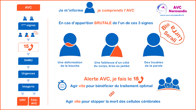 Les signes de l'AVC